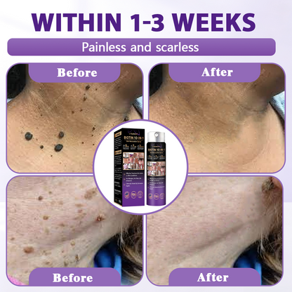 Made and Shipped from USA ✨Evolvion® Biotin 10-in-1 Skin Restoration Spray 🍀