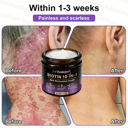 Made and Shipped from USA ✨Evolvion® Biotin 10-in-1 Skin Restoration Cream