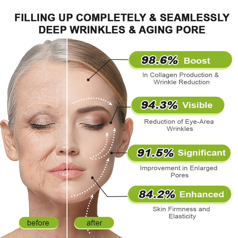 👨‍⚕️✅ Made and shipped from the USA – Rolimey® Botox & Vita-A Retinol Shot tightening and wrinkle-reducing cream – Last day of promotion, 70% OFF