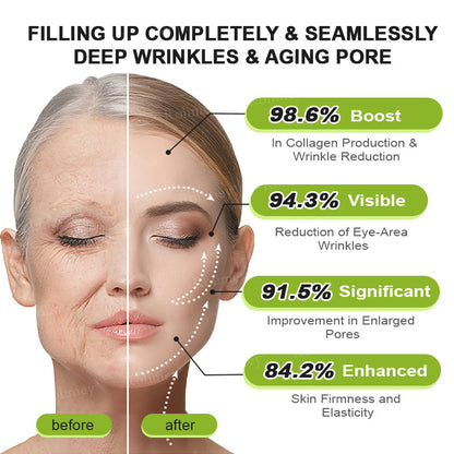 👨‍⚕️✅ Made and shipped from the USA – Rolimey® Botox & Vita-A Retinol Shot tightening and wrinkle-reducing cream – Last day of promotion, 70% OFF