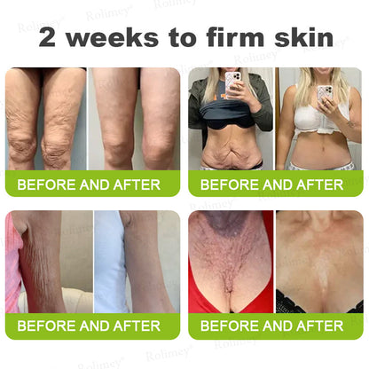 👨‍⚕️✅ Made and shipped from the USA – Rolimey® Botox & Vita-A Retinol Shot tightening and wrinkle-reducing cream – Last day of promotion, 70% OFF