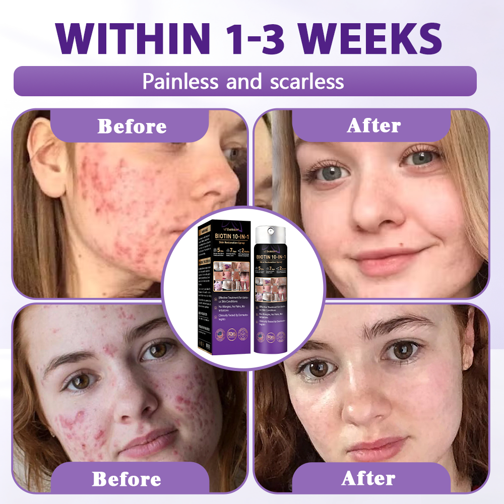 Made and Shipped from USA ✨Evolvion® Biotin 10-in-1 Skin Restoration Spray 🍀